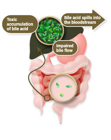 chld-Healthy liver Mobile