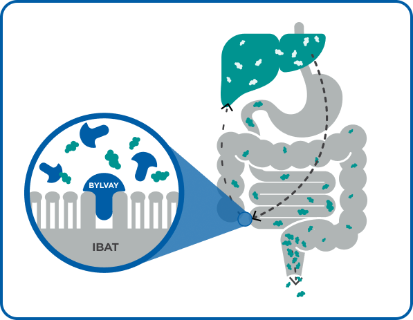 Diagram shows BYLVAY acting in IBAT.