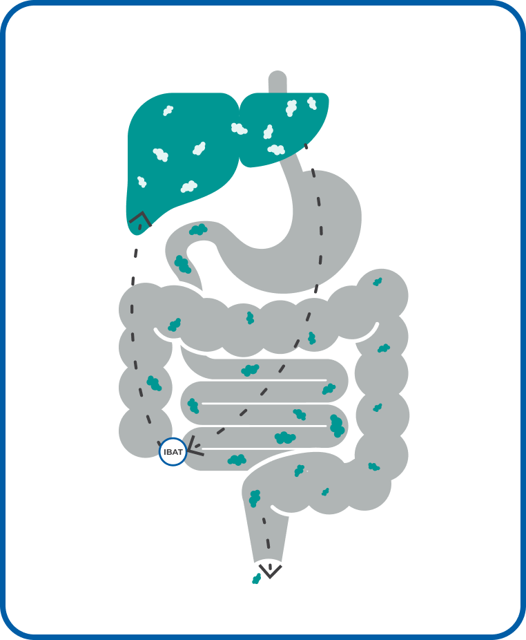 Diagram of normal circulation of bile acids. Bile acids flow from liver to small intestine, then they are recycled back to the liver by IBAT.