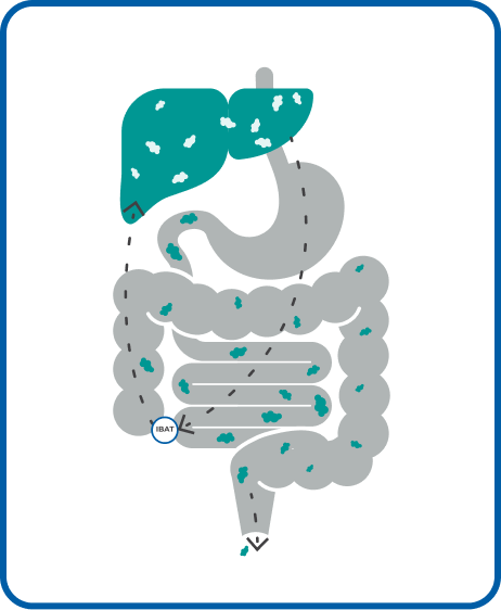 Diagram of normal circulation of bile acids. Bile acids flow from liver to small intestine, then they are recycled back to the liver by IBAT.